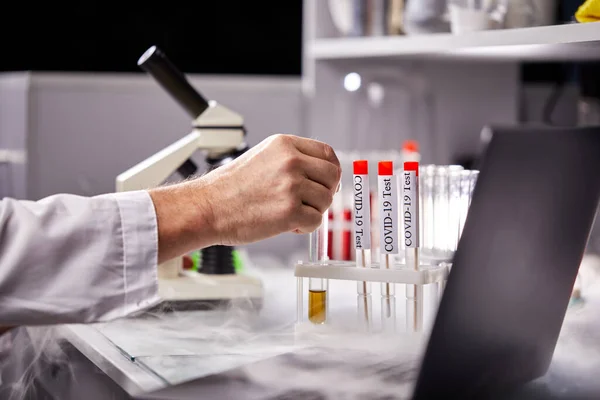 A mikrobiológus emberi vérből kivont plazmát tartalmazó kémcsöveket tart — Stock Fotó