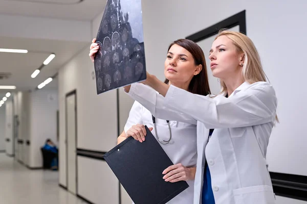 생물 의학 알고리즘 화면을 보고 있는 두 명의 여성 의사와 뇌의 폐포를 탐지하는 기계 학습 — 스톡 사진