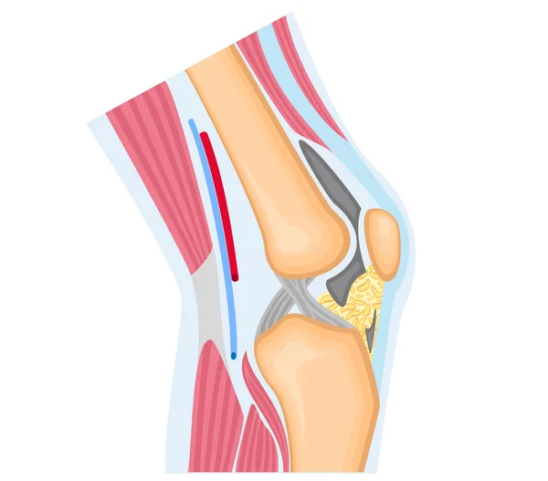 Térd közös anatomy elszigetelt fehér — Stock Vector