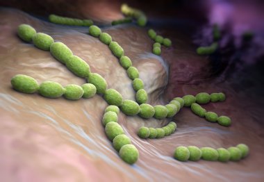Streptococcus pneumoniae 
