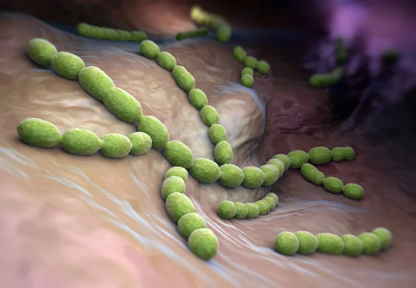 Streptococcus pneumoniae 