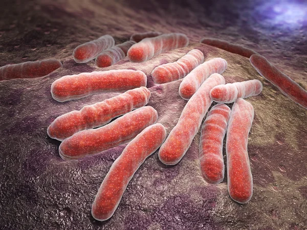 Бактериальная инфекция туберкулеза — стоковое фото