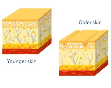 Younger skin and aging skin. clipart