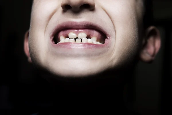 Child teeth — Stock Photo, Image