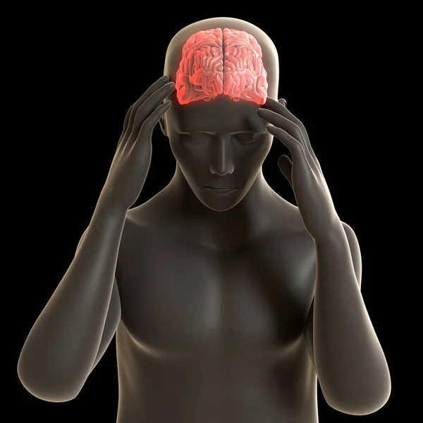 Illustration Shows Man Suffering Headache Version — Foto de Stock