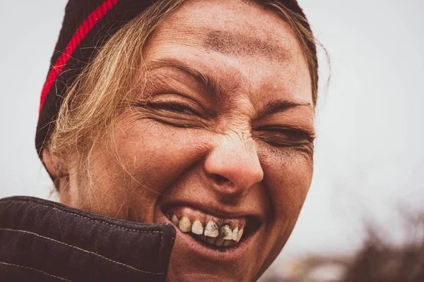 Close-up of a dirty woman\'s face. A dirty bum smiles and shows black teeth on the background of a landfill. Free space for text