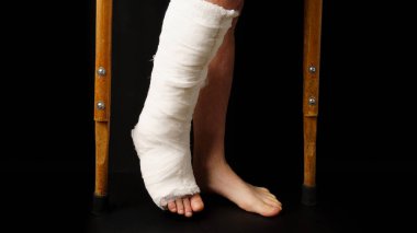 Kırık bilekli ve bacağında beyaz bandajlı siyah arka planda koltuk değneklerine yaslanan bir adam.