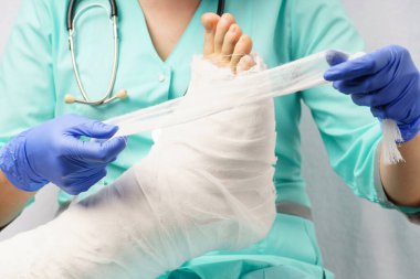 Doktorun randevusunda bacağı kırık bir adam. Doktor adama alçı yapıştırdı..