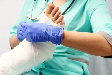 Kırık bacak. Doktor hastanın bacağına alçı alçı uygular. Yaralanmalardan sonra tedavi ve rehabilitasyon