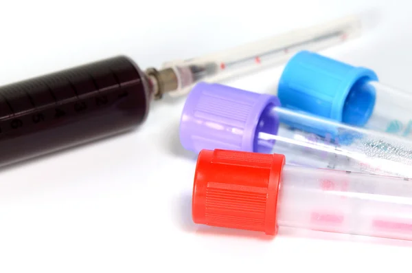 Blood Test in medische diagnose Concept voorbereiden. — Stockfoto