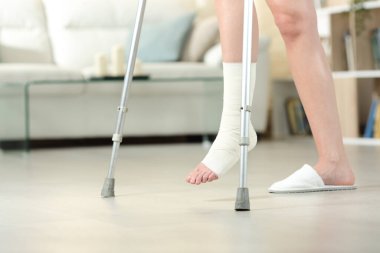 Side view portrait of a disabled woman with bandaged foot walking with crutches at home clipart