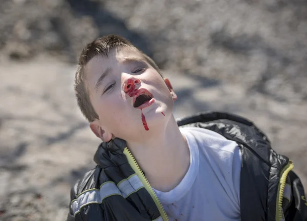 Bleeding Face — Stock Photo, Image