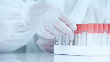 Laboratuar çalışanını kapat. Kan örneğini tüpte tut ve rafa koy..