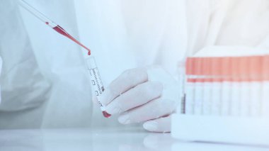 Laboratuar çalışanını kapat. Kan örneğini tüpte tut ve rafa koy..