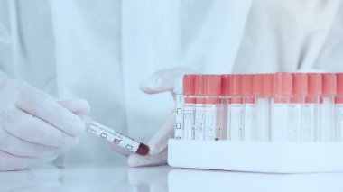 Laboratuar çalışanını kapat. Kan örneğini tüpte tut ve rafa koy..