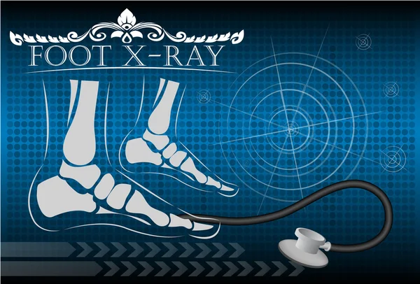 Τα πόδια x-ray, εικονογράφηση φορέας. — Διανυσματικό Αρχείο