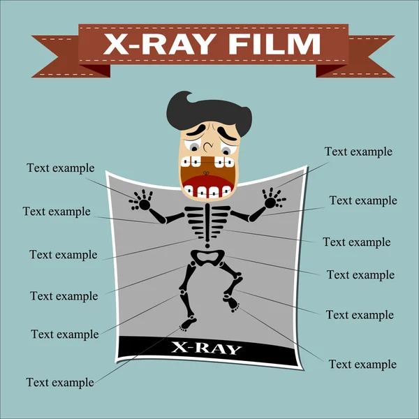 X-ray film — Stock Vector