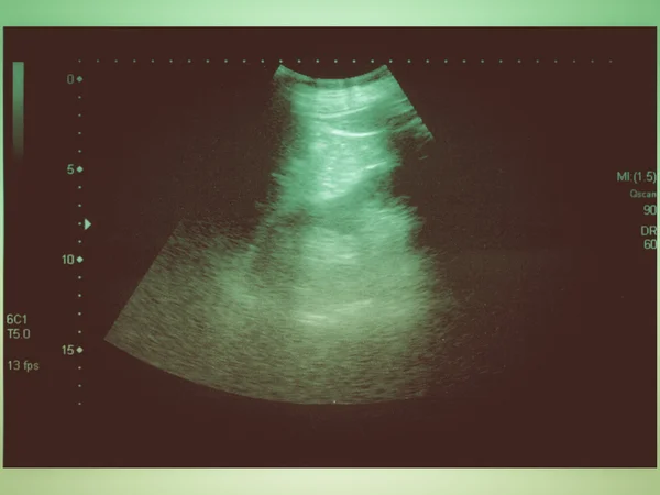 Retro look Ultrasound scan