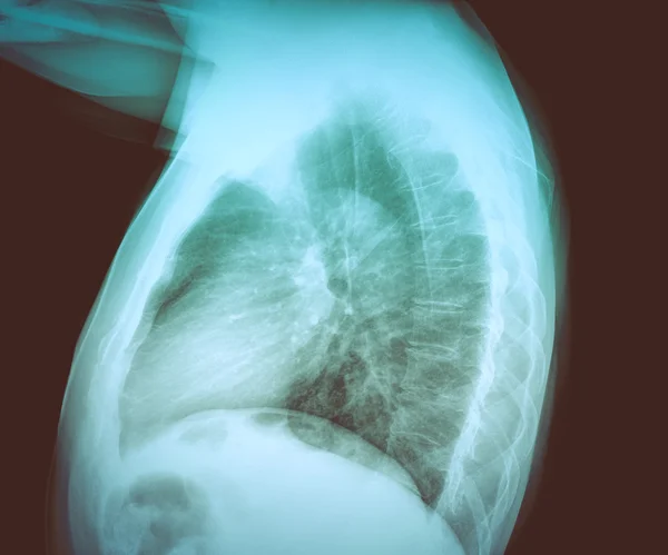 Вінтажний Вигляд Медичні Рентгенівські Промені — стокове фото