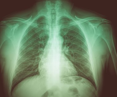 vintage tıbbi röntgen arıyorsunuz