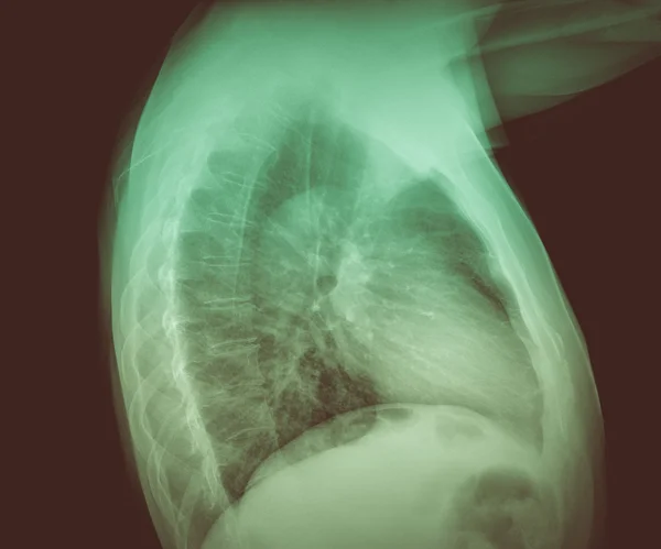 Retro-look medicinsk röntgen — Stockfoto