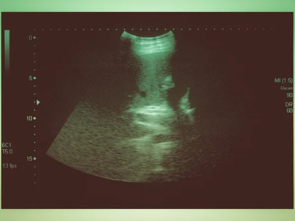 Ultrasound of fetus — Stock Photo © kubais #5232749