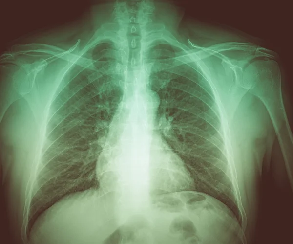 Retro spojrzenie medyczne rentgenowskie — Zdjęcie stockowe