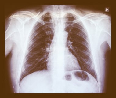 Retro Xray arıyorsunuz