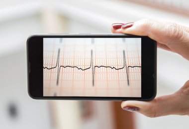 Mobil kavramı Elektrokardiyogram: kadın electrocardiog analiz