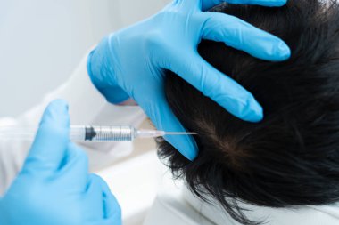 Asyalı kadın için saç iğnesi, saç dökülmesi, saç dökülmesi, seyreltme, vitamin eksikliği, kellik, doğum sonrası, biyotin, çinko, endokrin bozuklukları, hormonal dengesizlik uzmanı.