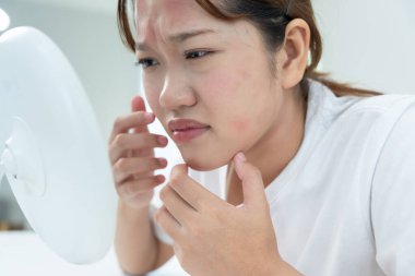 Genç Asyalı kadın, yüz dermatolojisi ve kozmetik ürünlerinde steroidlere alerjisi olduğu için endişeli. Hassas cilt, güneş yanığı, sivilce, kimyasallara alerjisi, yüzünde kızarıklık. cilt sorunları ve güzellik
