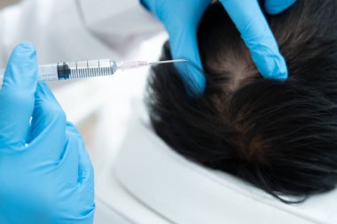 Asyalı erkek için saç enjeksiyonu, saç dökülmesi, saç dökülmesi, seyreltme, vitamin eksikliği, kellik, doğum sonrası, biyotin, çinko, endokrin bozuklukları, hormonal dengesizlik uzmanı.