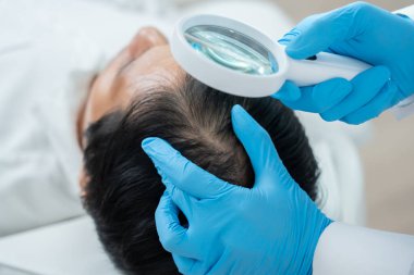 Asyalı erkek için saç sağlığı, saç dökülmesi, saç dökülmesi, seyreltme, vitamin eksikliği, kellik, doğum sonrası, biyotin, çinko, endokrin bozuklukları, hormonal dengesizlik uzmanı.