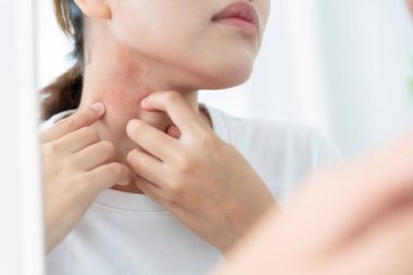 Cilt ve güzellik sorunları Kadınların kaşındıran derileri ve kozmetik alerjileri, steroid alerjileri, hassas ciltleri, güneş ışığı kızarıklıkları, kimyasal alerjileri, isilikleri, böcek ısırıkları yüzünden kızarıklıkları var..