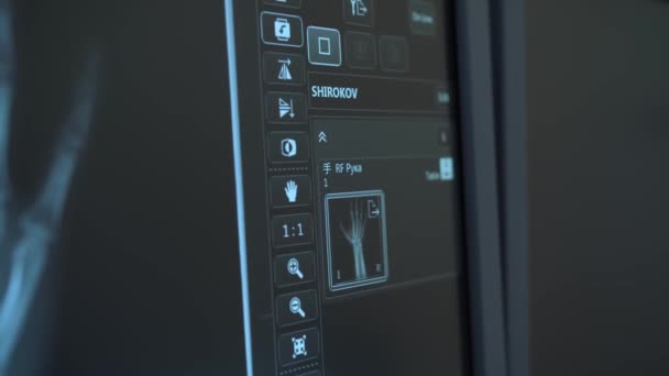 Gros Plan Radiographie Main Sur Moniteur Équipement Médical Panorama Par — Video