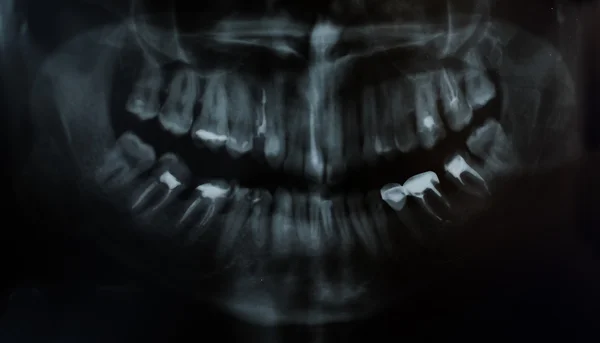 Imagen de una mandíbula dental — Foto de Stock