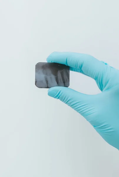 Closeup Hand Blue Glove Holding Small Dental Ray Isolated White — Stock Photo, Image