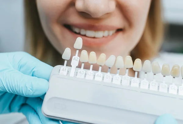 Zbliżenie Uśmiechniętej Kobiety Pasującej Odcieni Zębów Implantu Zdjęcie Stockowe