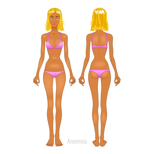 Mujer gorda y delgada, ilustración vectorial, normal, cuerpo anorexia — Vector de stock