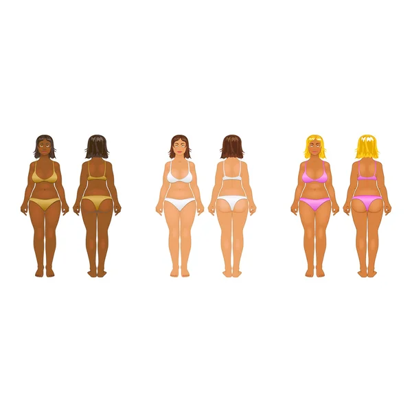 Mujer gorda y delgada, ilustración vectorial, normal, cuerpo anorexia — Archivo Imágenes Vectoriales