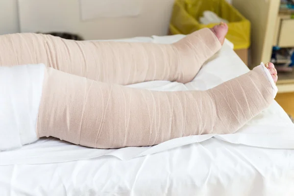 Bandaged patient's legs — Stock Photo, Image