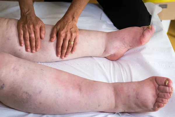 Woman doing lymphatic drainage massage — Stock Photo, Image