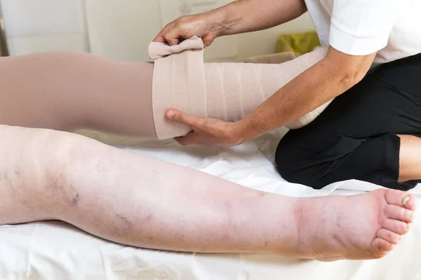 Mulher ligando as pernas do paciente — Fotografia de Stock