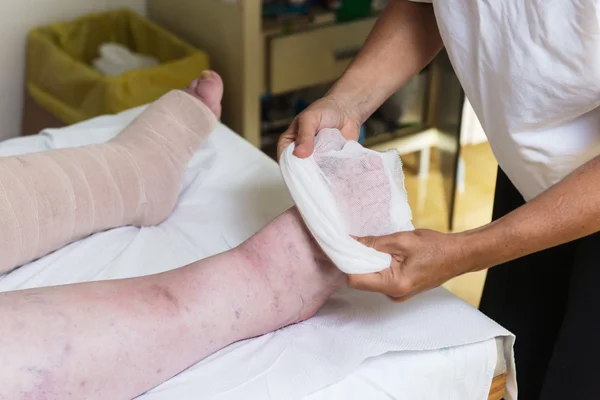 Frau bandagiert Patientin die Beine — Stockfoto