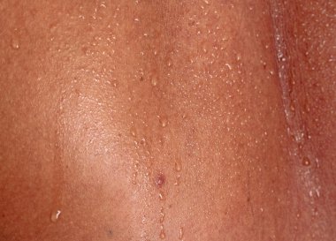 İnsan derisi ve ter