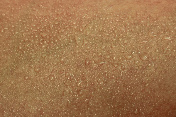 人体皮肤和汗水 — 图库照片