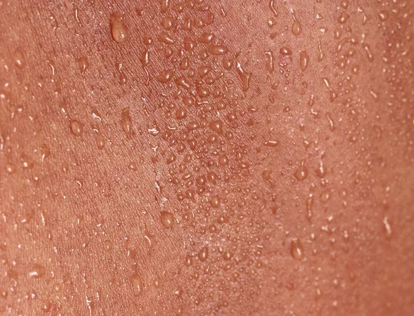 Human Skin and Sweat — Stock Photo, Image