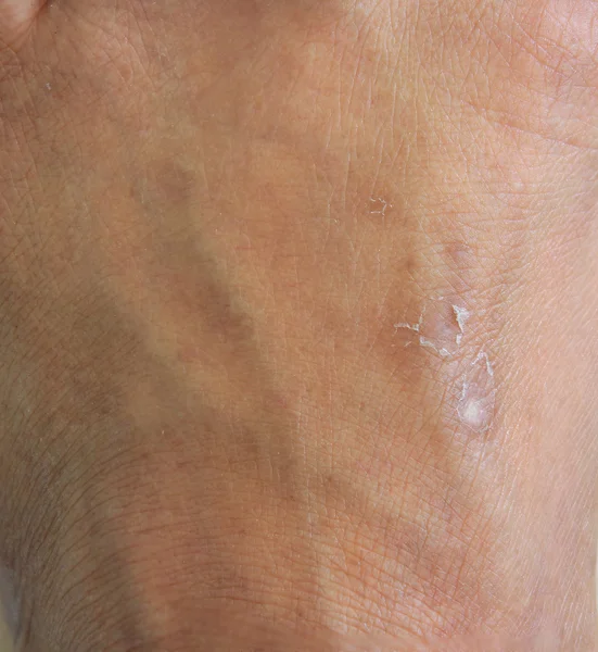 Textura de la piel humana — Foto de Stock