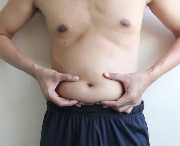 Paunch persona gorda —  Fotos de Stock