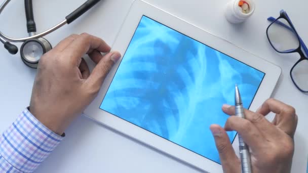 Чоловік-лікар тримає аналіз рентгенівської фотографії на цифровому планшеті крупним планом — стокове відео